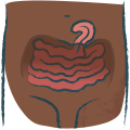 Abdominal Hernias