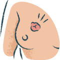 Breast Disease Surgery
